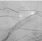 grafene 3 (wikipedia)